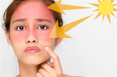 Mua kem chống nắng ở đâu tốt, uy tín chất lượng