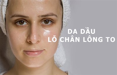 CÁCH CHĂM SÓC DA NHỜN VÀ LỖ CHÂN LÔNG TO