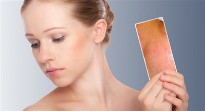 TUYỆT CHIÊU CẢI THIỆN TÌNH TRẠNG LỖ CHÂN LÔNG TO HIỆU QUẢ